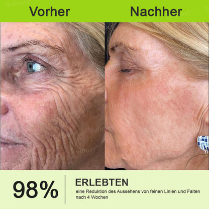 🌿👨‍⚕️Jetzt jugendliche Haut zurückgewinnen 💫Rolimey® Botox & Vita-A Retinol Shot Falten-Lift Straffungscreme