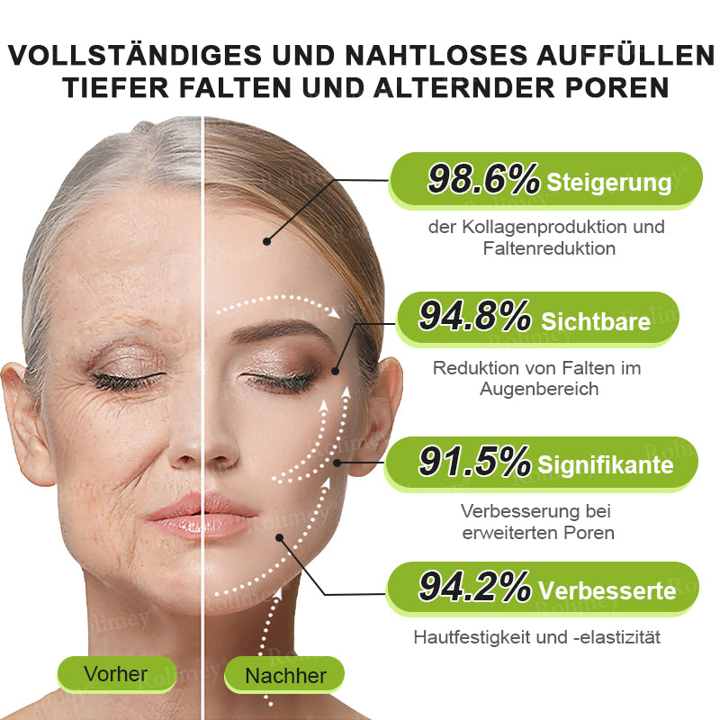 🌿👨‍⚕️Jetzt jugendliche Haut zurückgewinnen 💫Rolimey® Botox & Vita-A Retinol Shot Falten-Lift Straffungscreme