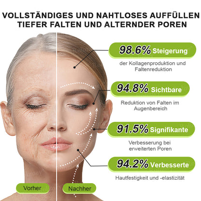 🌿👨‍⚕️Jetzt jugendliche Haut zurückgewinnen 💫Rolimey® Botox & Vita-A Retinol Shot Falten-Lift Straffungscreme