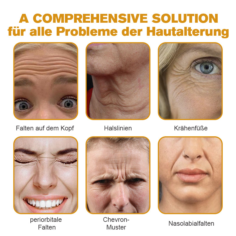 ✨🍀Jetzt jugendliche Haut zurückgewinnen ✅Furzero™ Botox Bienengift Falten- und Fleckencreme-Letzter Tag der Aktion: 70 % Rabatt