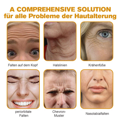 ✨🍀Jetzt jugendliche Haut zurückgewinnen ✅Furzero™ Botox Bienengift Falten- und Fleckencreme-Letzter Tag der Aktion: 70 % Rabatt