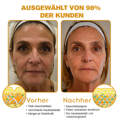 ✨🍀Jetzt jugendliche Haut zurückgewinnen ✅Furzero™ Botox Bienengift Falten- und Fleckencreme-Letzter Tag der Aktion: 70 % Rabatt