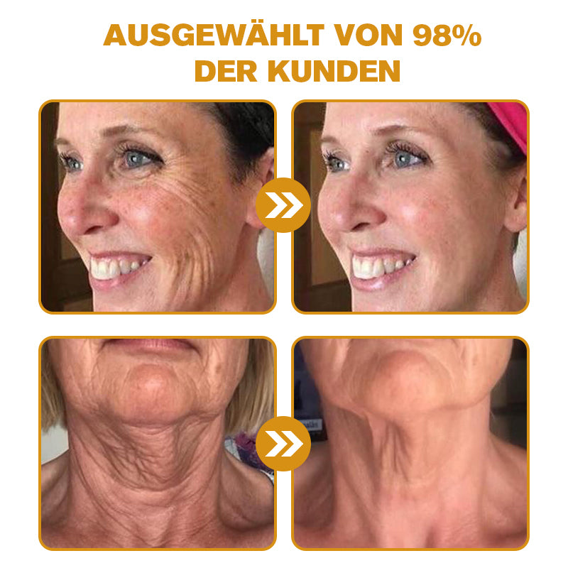 ✨🍀Jetzt jugendliche Haut zurückgewinnen ✅Furzero™ Botox Bienengift Falten- und Fleckencreme-Letzter Tag der Aktion: 70 % Rabatt
