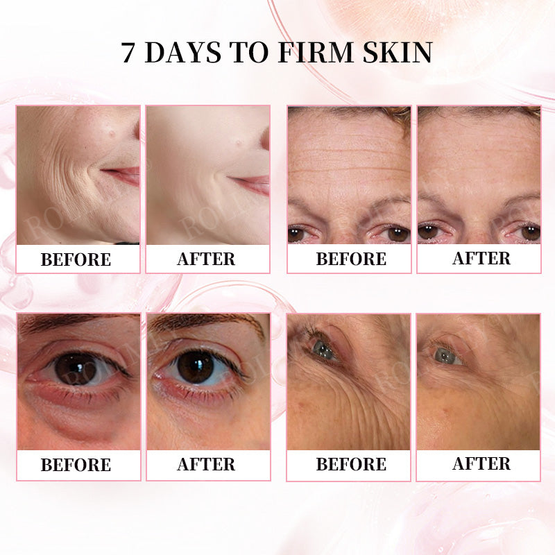 👨‍⚕️😍Made and Shipped from Australia✅Rolimey®Botox & Stem Cell Firming Anti-Wrinkle Cream Last Day 70% OFF!