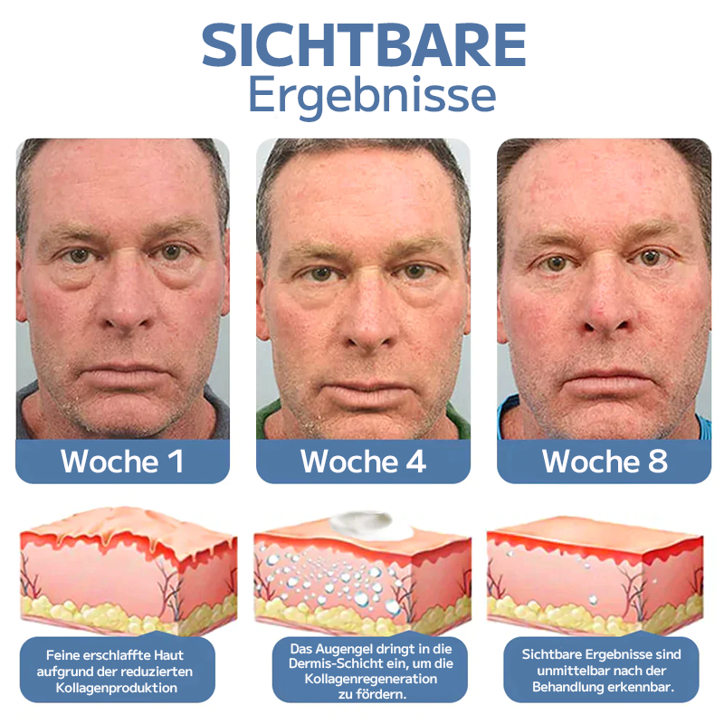 OPENEYES Erwachen Peptid-Straffendes Augengel-