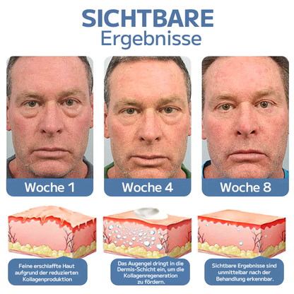 OPENEYES Erwachen Peptid-Straffendes Augengel-