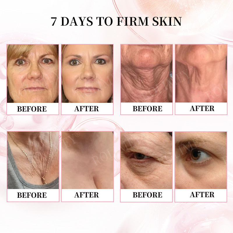 👨‍⚕️😍Made and Shipped from Australia✅Rolimey®Botox & Stem Cell Firming Anti-Wrinkle Cream Last Day 70% OFF!