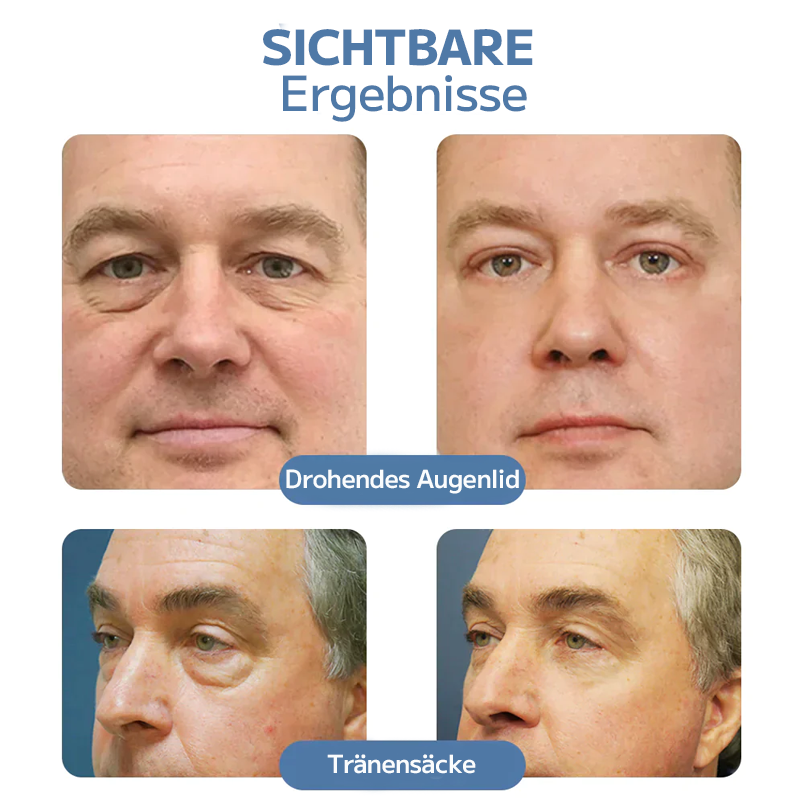 OPENEYES Erwachen Peptid-Straffendes Augengel-