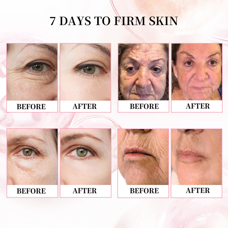 👨‍⚕️😍Made and Shipped from Australia✅Rolimey®Botox & Stem Cell Firming Anti-Wrinkle Cream Last Day 70% OFF!