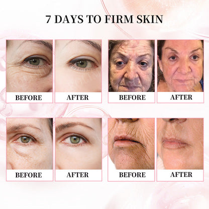👨‍⚕️😍Made and Shipped from Australia✅Rolimey®Botox & Stem Cell Firming Anti-Wrinkle Cream Last Day 70% OFF!