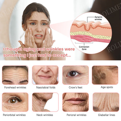 👨‍⚕️😍Made and Shipped from Australia✅Rolimey®Botox & Stem Cell Firming Anti-Wrinkle Cream Last Day 70% OFF!