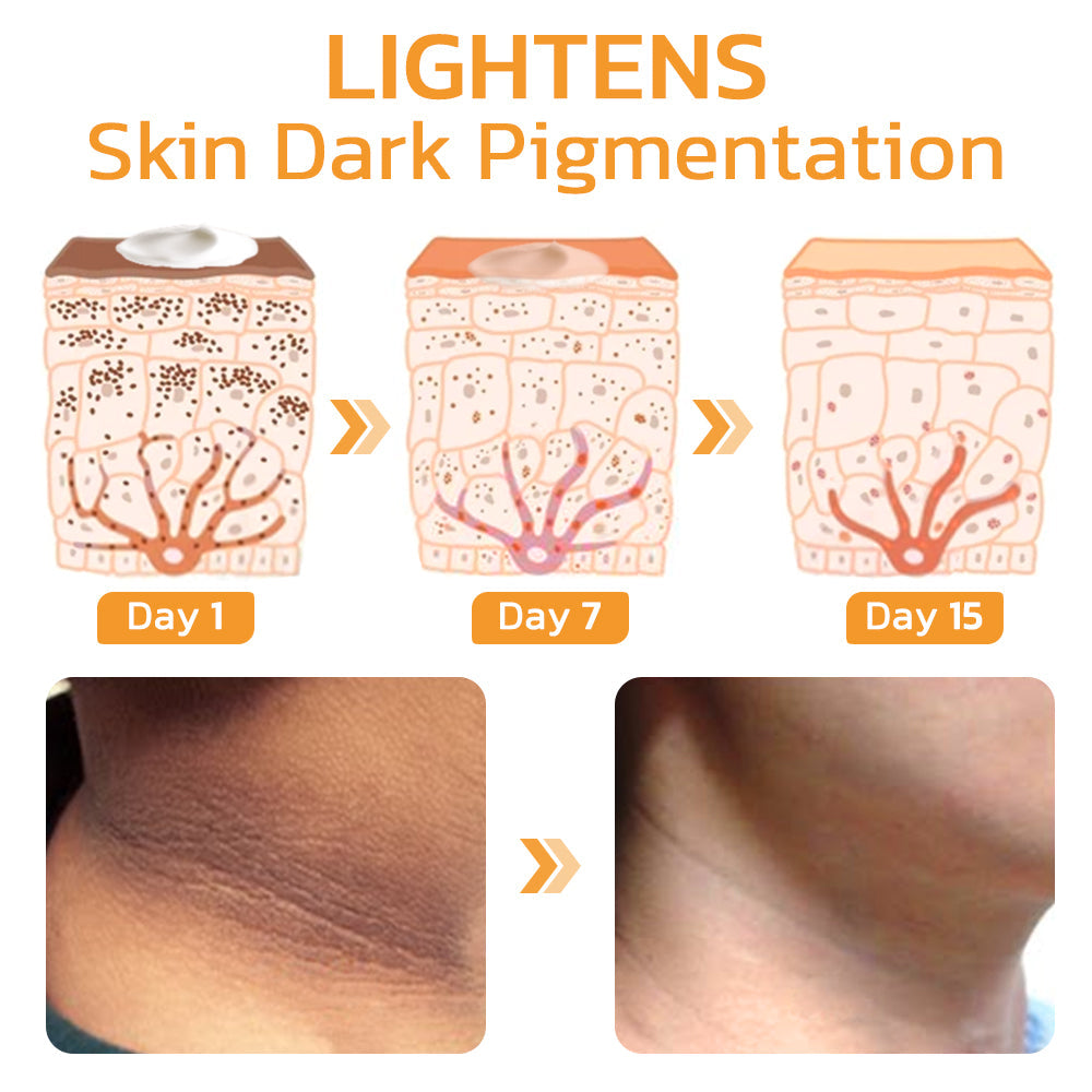 🧡GFOUK™ FAFASKIN Rückenflecken und Akanthose Nigricans Reinigungslotion-Letzter Tag: 50 % Rabatt
