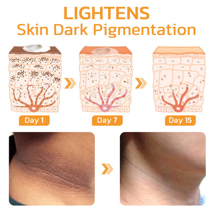 🧡GFOUK™ FAFASKIN Rückenflecken und Akanthose Nigricans Reinigungslotion-Letzter Tag: 50 % Rabatt
