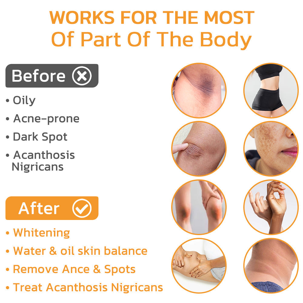 🧡GFOUK™ FAFASKIN Rückenflecken und Akanthose Nigricans Reinigungslotion-Letzter Tag: 50 % Rabatt