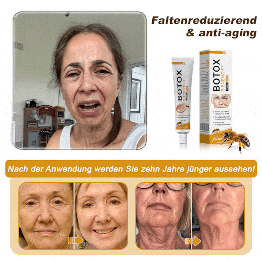 ✨🍀Jetzt jugendliche Haut zurückgewinnen ✅Furzero™ Botox Bienengift Falten- und Fleckencreme-Letzter Tag der Aktion: 70 % Rabatt