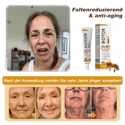 ✨🍀Jetzt jugendliche Haut zurückgewinnen ✅Furzero™ Botox Bienengift Falten- und Fleckencreme-Letzter Tag der Aktion: 70 % Rabatt