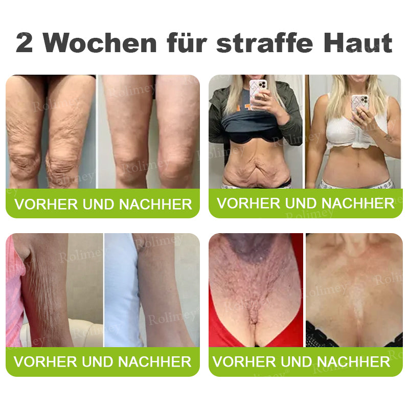 🌿👨‍⚕️Jetzt jugendliche Haut zurückgewinnen 💫Rolimey® Botox & Vita-A Retinol Shot Falten-Lift Straffungscreme