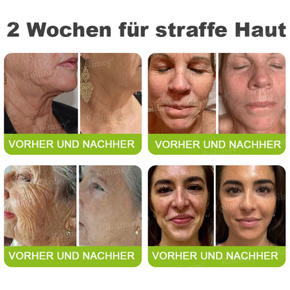 🌿👨‍⚕️Jetzt jugendliche Haut zurückgewinnen 💫Rolimey® Botox & Vita-A Retinol Shot Falten-Lift Straffungscreme